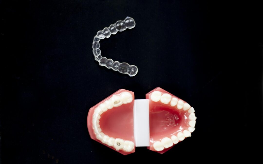 does invisalign correct an overbite