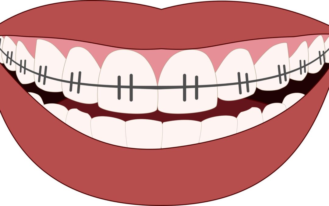 eagan orthodontics